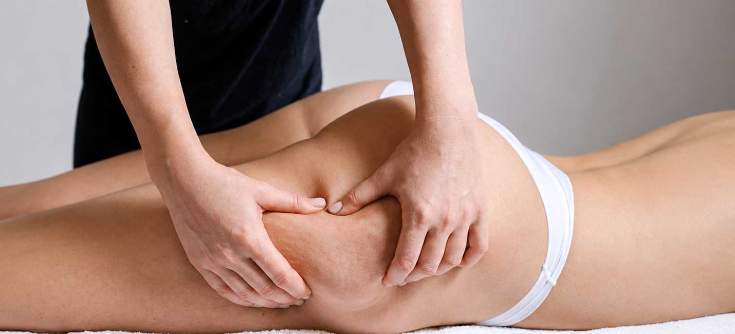 How to Prevent and Reduce Cellulite: A Complete Guide