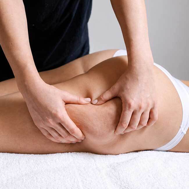 How to Prevent and Reduce Cellulite: A Complete Guide